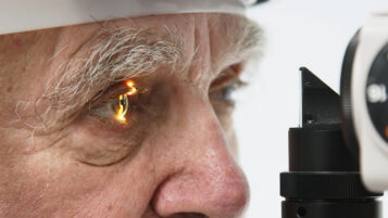 The facts about glaucoma
