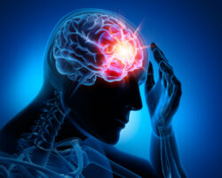 What happens to the brain during a stroke?