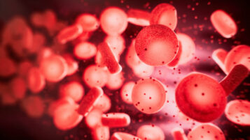 What you need to know about sepsis