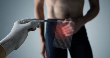 Hernia treatment: What to know about surgery and recovery