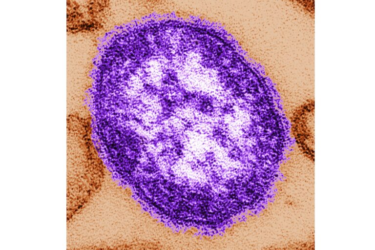 Pennsylvania Reports First 2 Measles-Related Deaths in the US This Year